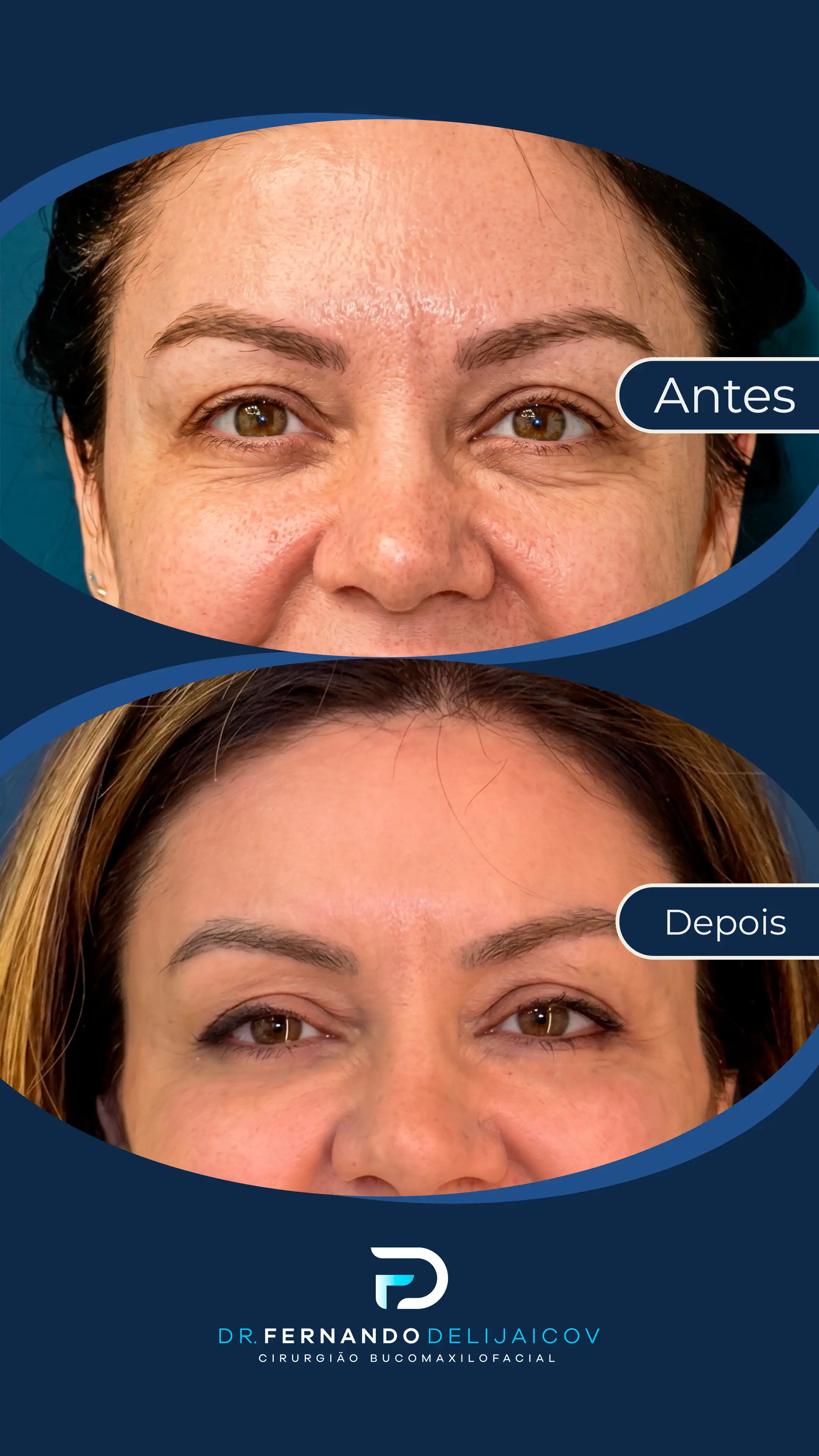Resultado antes e depois 3